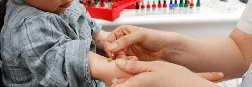 Bebeklerde Alerji Testi Nasıl Yapılır